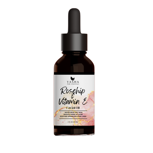 Rosehip & Vitamin E Facial Oil (7536206053618)
